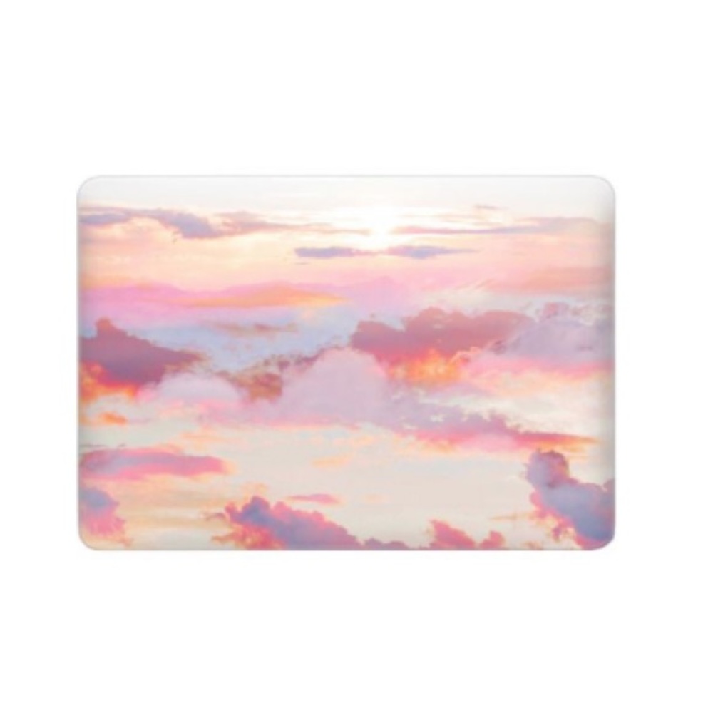 Casetify MacbookPro 13” Case